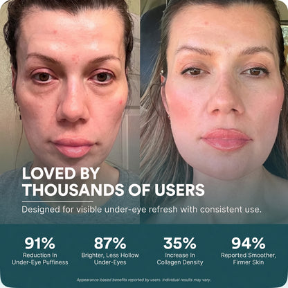 EyeReset™ Rested Look Glasses